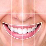 Imagen de imagen destacada - Diseño de sonrisa