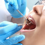 Imagen de imagen destacada - Endodoncia