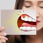 Imagen de imagen destacada - Periodoncia